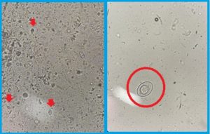 ハムスター下痢
